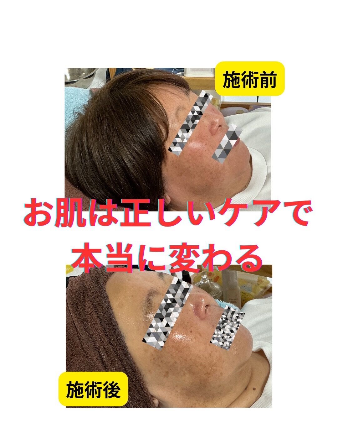 お肌は正しいケアで本当に変わる